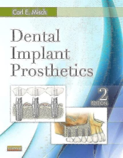 Dental Implant Prosthetics 2nd Edition