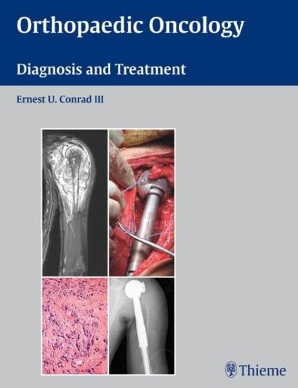 Orthopaedic Oncology: Diagnosis and Treatment