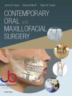 Contemporary Oral and Maxillofacial Surgery 7th Edition