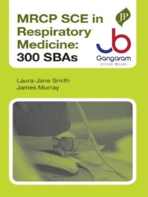 MRCP SCE in Respiratory Medicine 300 SBAs